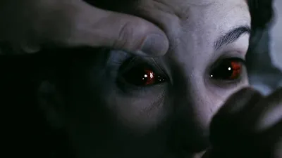 Infección izle